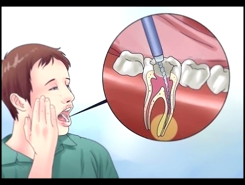 ЗУБНАЯ БОЛЬ ПОКИНЕТ ВАС НАВСЕГДА , если вы знаете этот секрет / как избавиться от зубной боли 